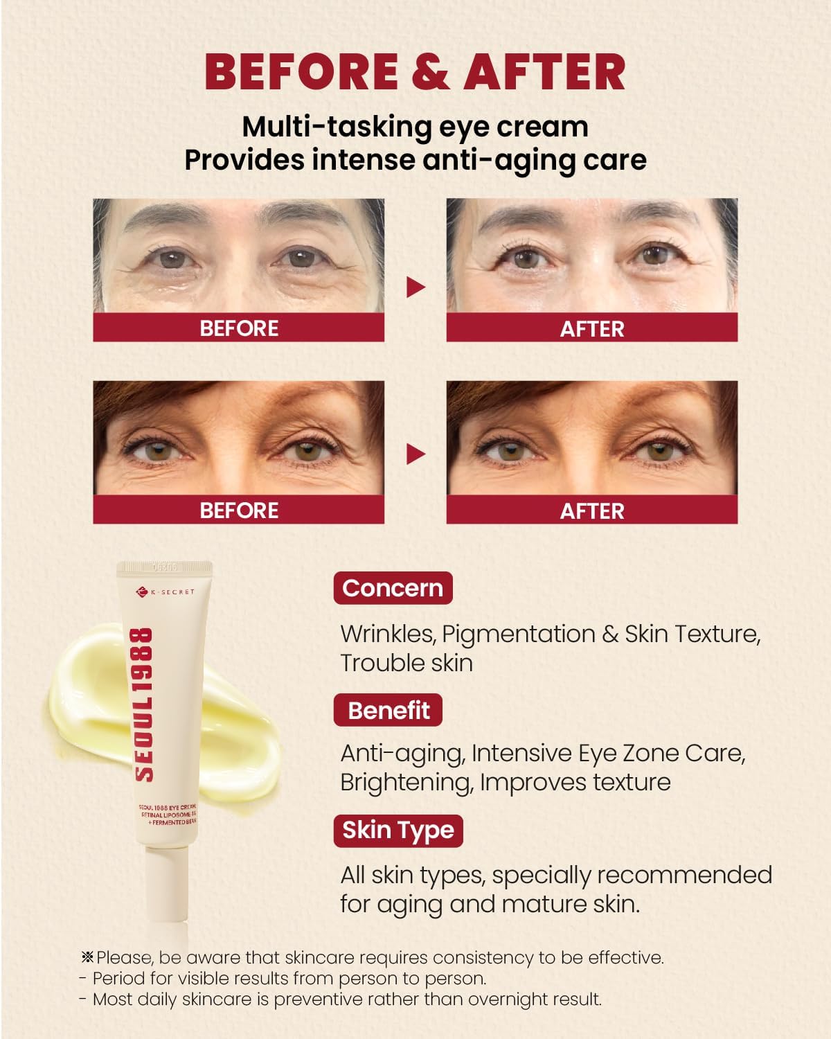 K - SECRET SEOUL 1988 - SEOUL 1988 Eye Cream: Retinal Liposome 4% + Fermented Bean 30ml